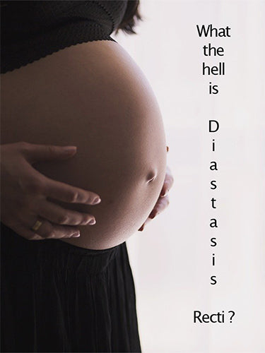 What is Diastasis Recti?